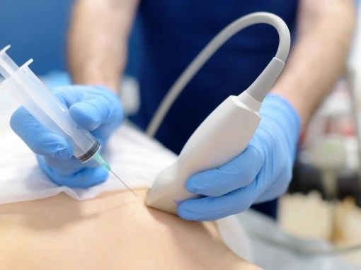 Biopsie à l’aiguille Fine Service