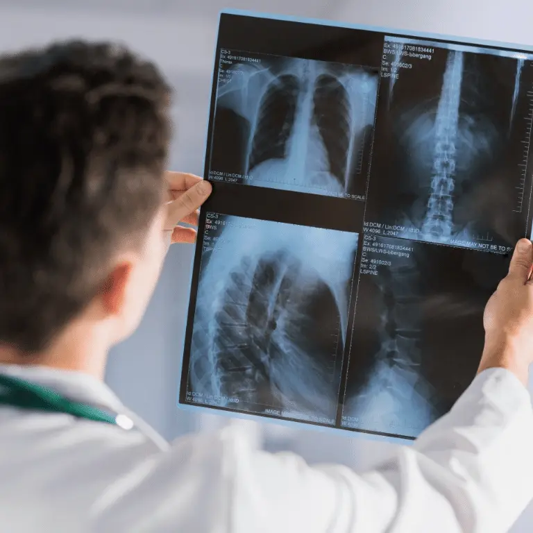 Équipements de Radiologie Moderne